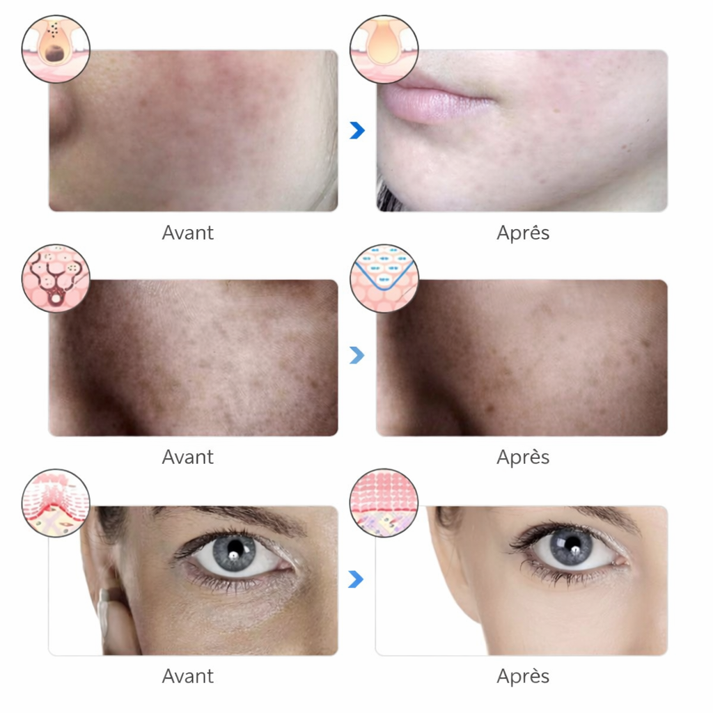 Masque LED Visage – Soin Réparateur et Rajeunissant