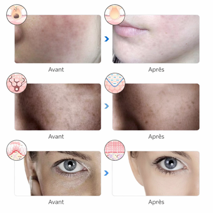 Masque LED Visage – Soin Réparateur et Rajeunissant